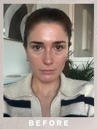 A selfie of Eleanor before her Sofwave treatment