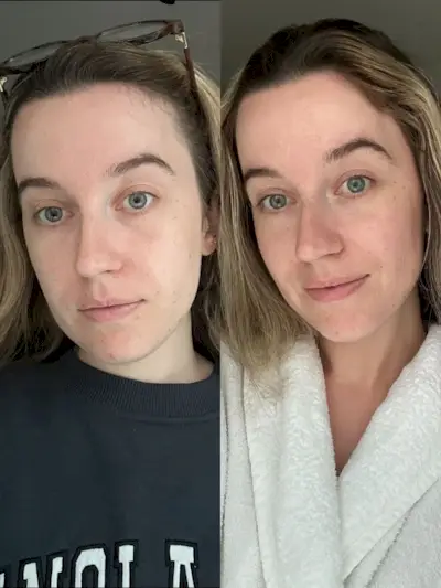 Junior beauty editor, Grace Lindsay, testing the Dr Dennis Gross LED mask