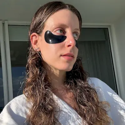 Photo of Jamie Schneider's skin 