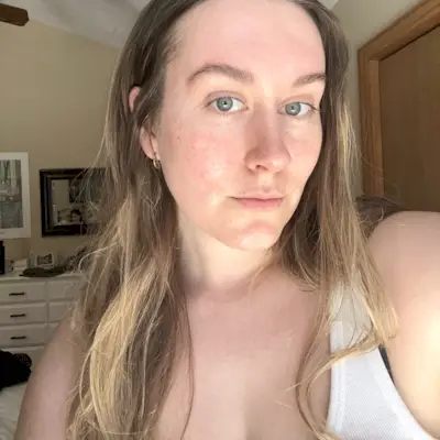 Beauty editor Kaitlyn McLintock after using the Qure Micro-Infusion System.