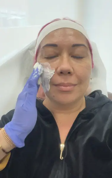 Numb before Skinvive