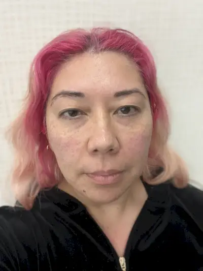 Skinvive Immediately After