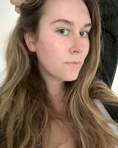 Beauty editor Kaitlyn McLintock's side profile after using Plated Skin Science serums