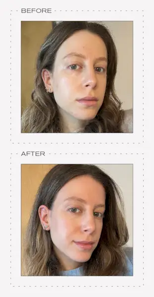 Jamie Schneider testing the Lyma Laser Pro