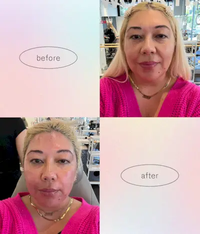 facegym-facial-workout-review-300045-1653086148714-main